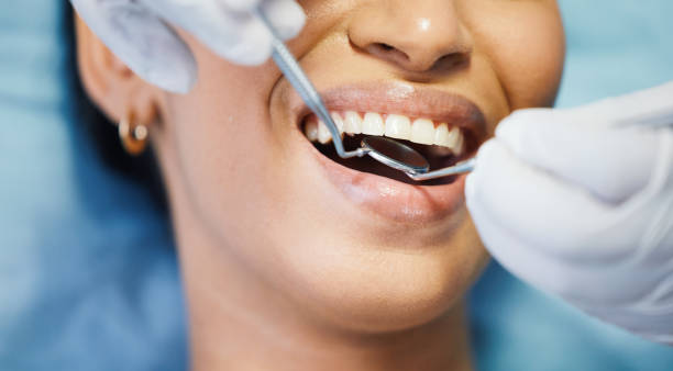 Best Broken or Cracked Tooth Emergency Dentist in Leipsic, OH